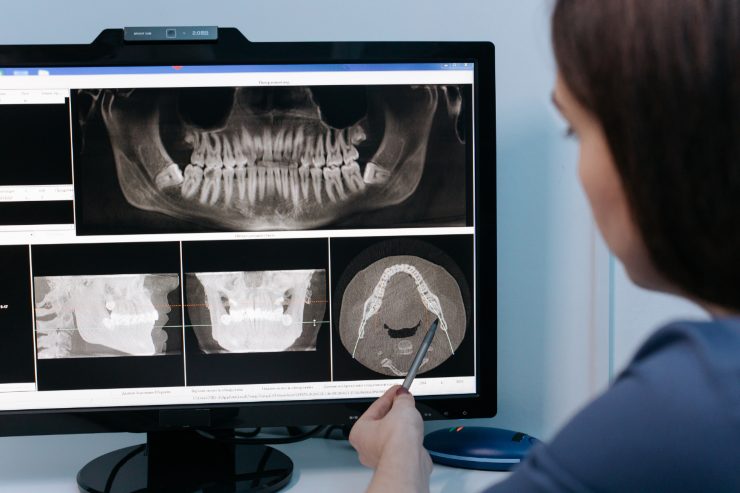 odontoiatra di fronte a radiografie